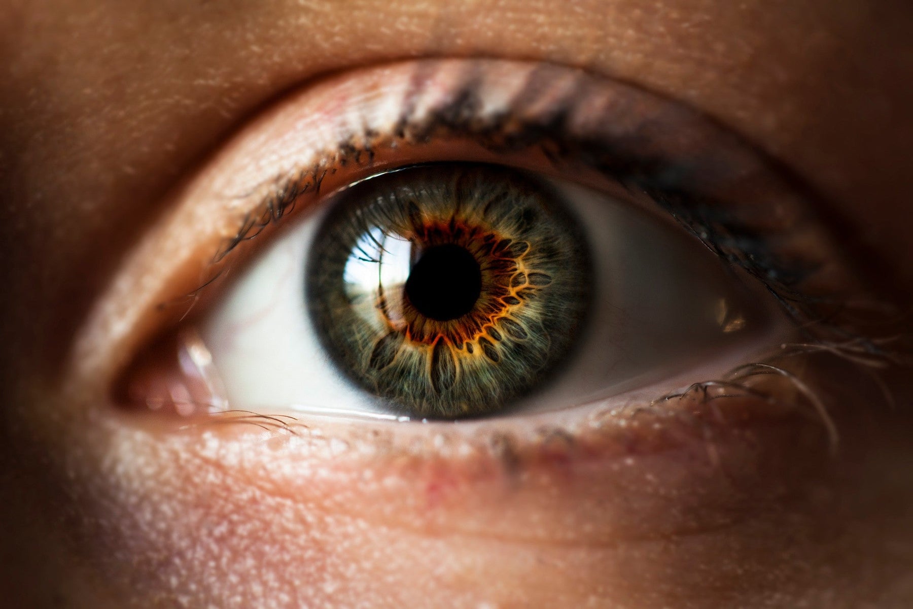 What Is Iridology And What Does An Iridologist Do?